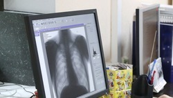 Новую флюорографическую установку передали в поликлинику Железноводска