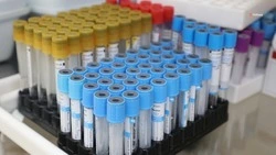 Современное оборудование для лаборатории получила ставропольская поликлиника