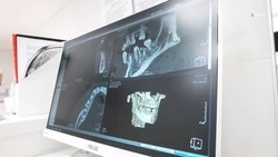 В детскую поликлинику на Ставрополье установили новое оборудование