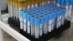 Проверяться на гепатит C нужно ежегодно — минздрав Ставрополья   